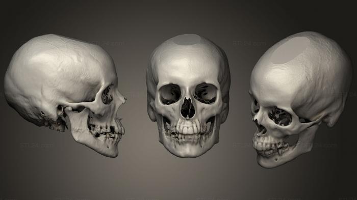 Anatomy of skeletons and skulls (Skull Female, ANTM_1283) 3D models for cnc